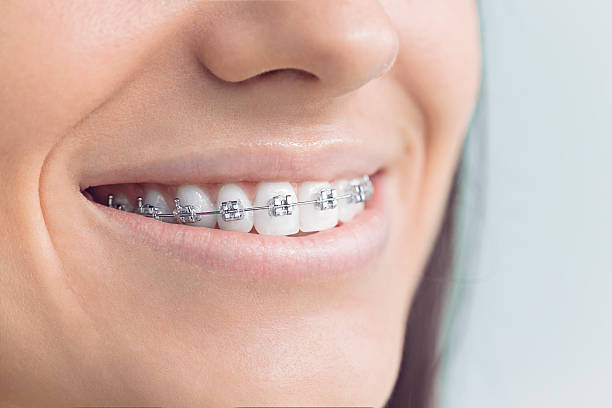 Best Dental Bonding  in Many, LA